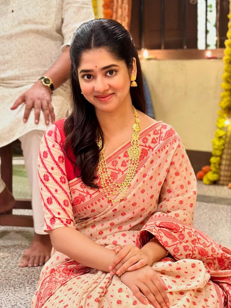 Chirodin Ei Tumi Je Amar serial rating : Popularity of Bengali serial : Bengali actress surgery news